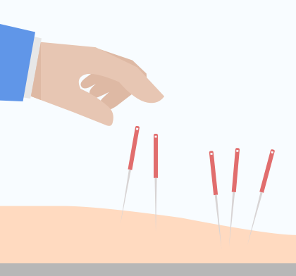 Acupuncture Remains Payable for CA Work Comp, Despite MUE